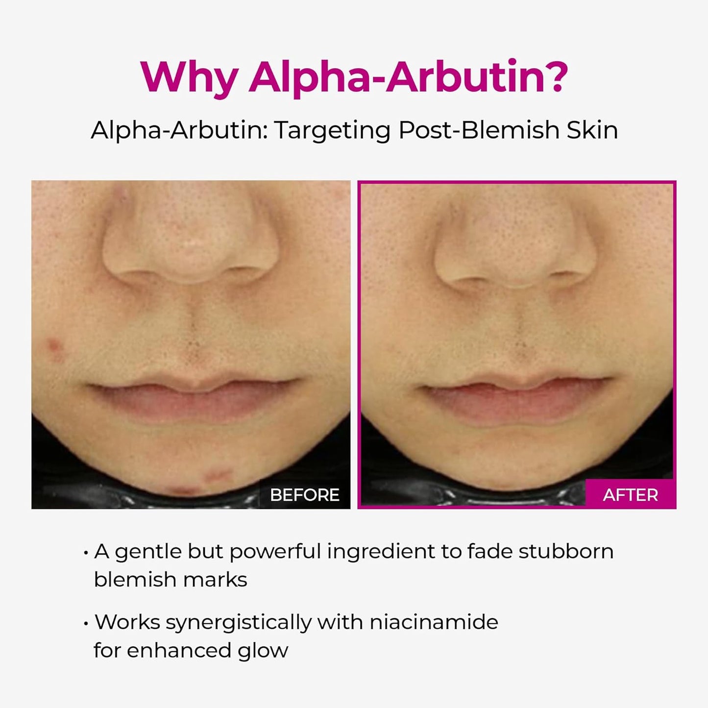 Cemenrete Picotonic Shot Calcium Ampoule for Even Skin Tone & Skin Clarity, 1.01 fl.oz.