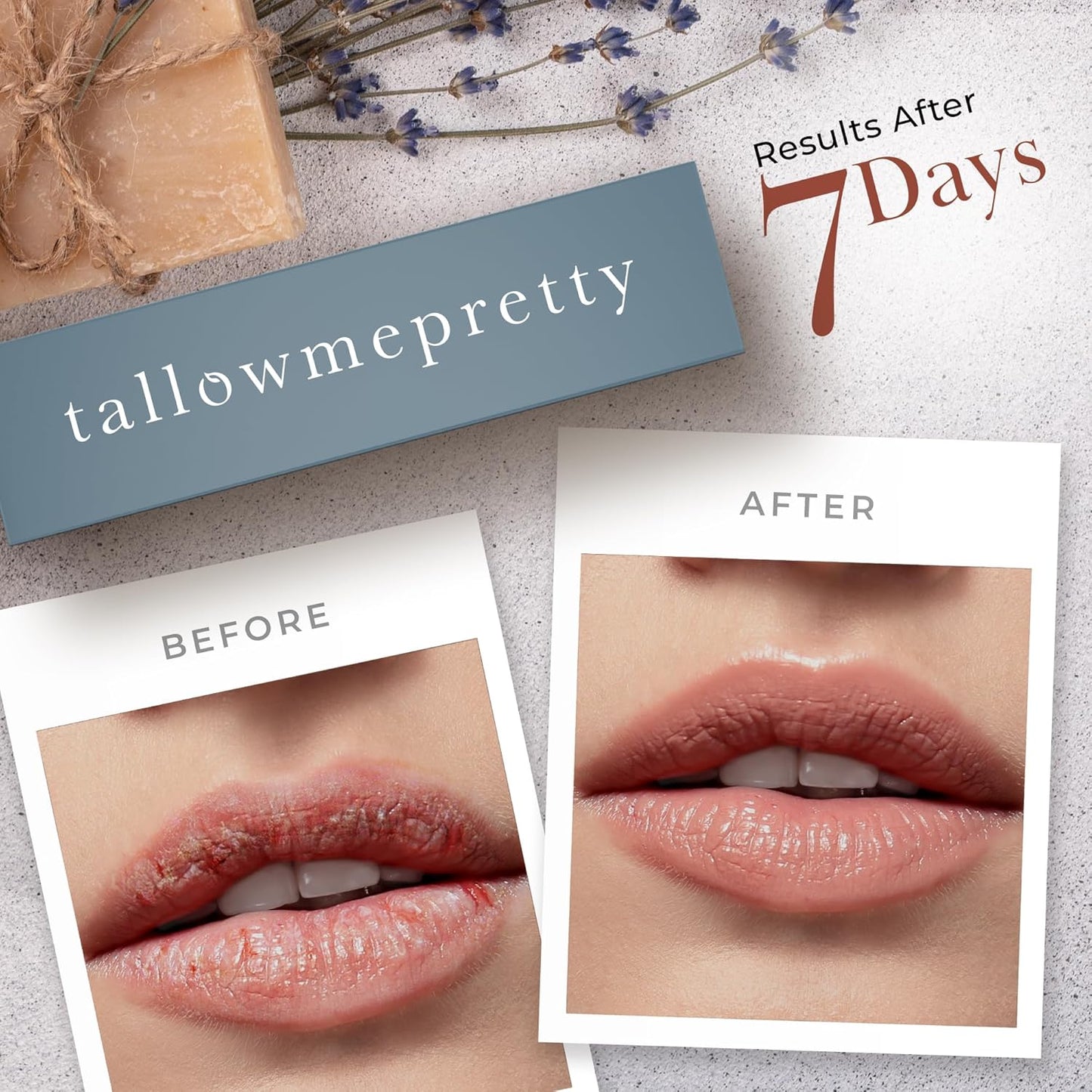 Peppermint Lip Balm, Ultra-Soothing, Deeply Hydrating Tallow Lip Balm with Grass Fed Beef Tallow, Beeswax, Jojoba Oil & More, Non Toxic Lip Care, Made in the USA, 0.15 Oz.