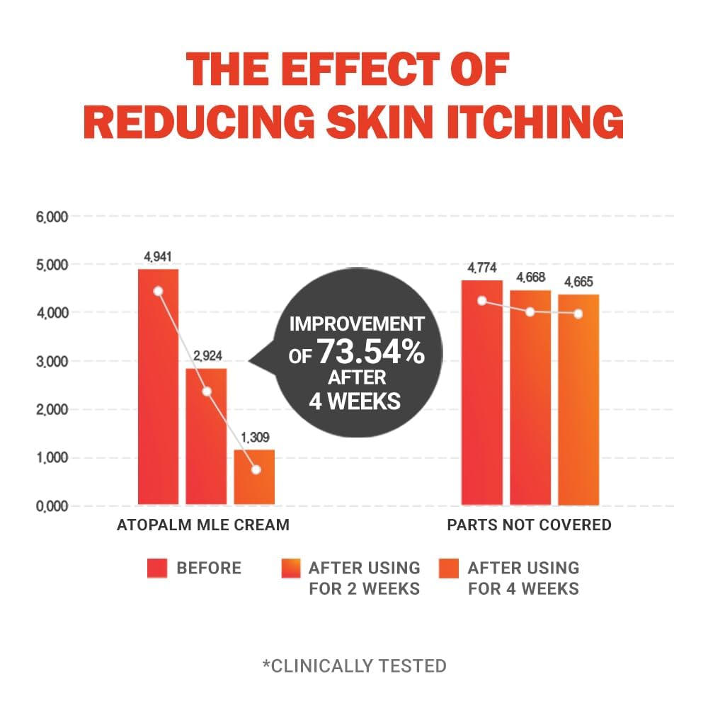 ATOPALM | MLE Eczema Cream | Premium Baby Lotion Newborn | Baby Face and Body Moisturizer for Skin Barrier | Moisturizing Facial Cream for Itchiness & Redness | Korean Skincare | 2.2 fl oz (65ml)