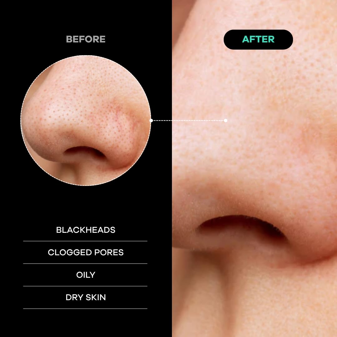 Dermasuri Deep Exfoliating Face Mitt - Scrubber, Dead and Dry Skin Remover for Men and Women - Exfoliator Gloves for Shower and Dry Use - ( 1 Pack)