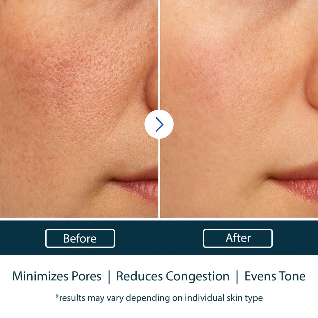 NAELI AHA/BHA Exfoliating Face Wash - 10% Glycolic Acid & Salicylic Acid Cleanser, Anti Aging Acne & Wrinkle Reducing Facial Exfoliant, Pore Minimizer & Brightening Gel, 4 oz