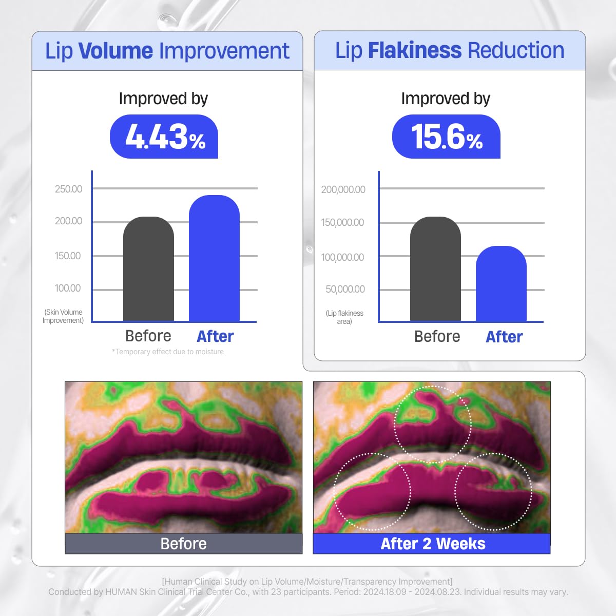 DERMATORY Hyalluron Peptide Volume Lip Mask Balm - Hydrating & Moisturizing Lip Mask for Day & Night Care (10ml)