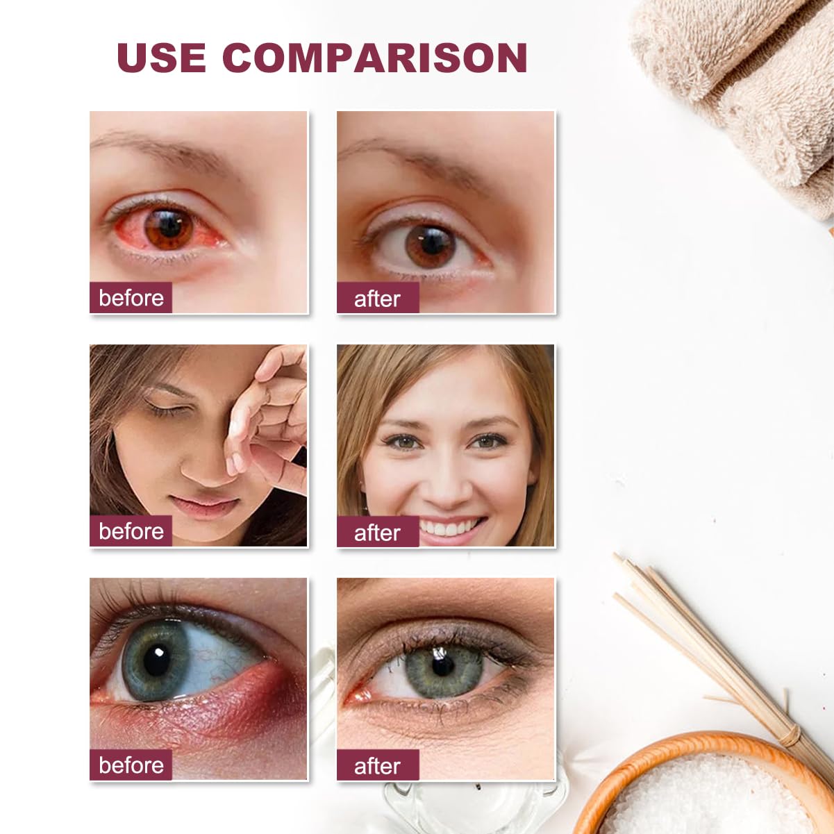 Stye Eye Treatment,Chalazion Remover,Stye Eye Relief Serum for Styes Chalazion and Blepharitis Treatment, Fast Relief,Mild Lash and Eye Cleanser