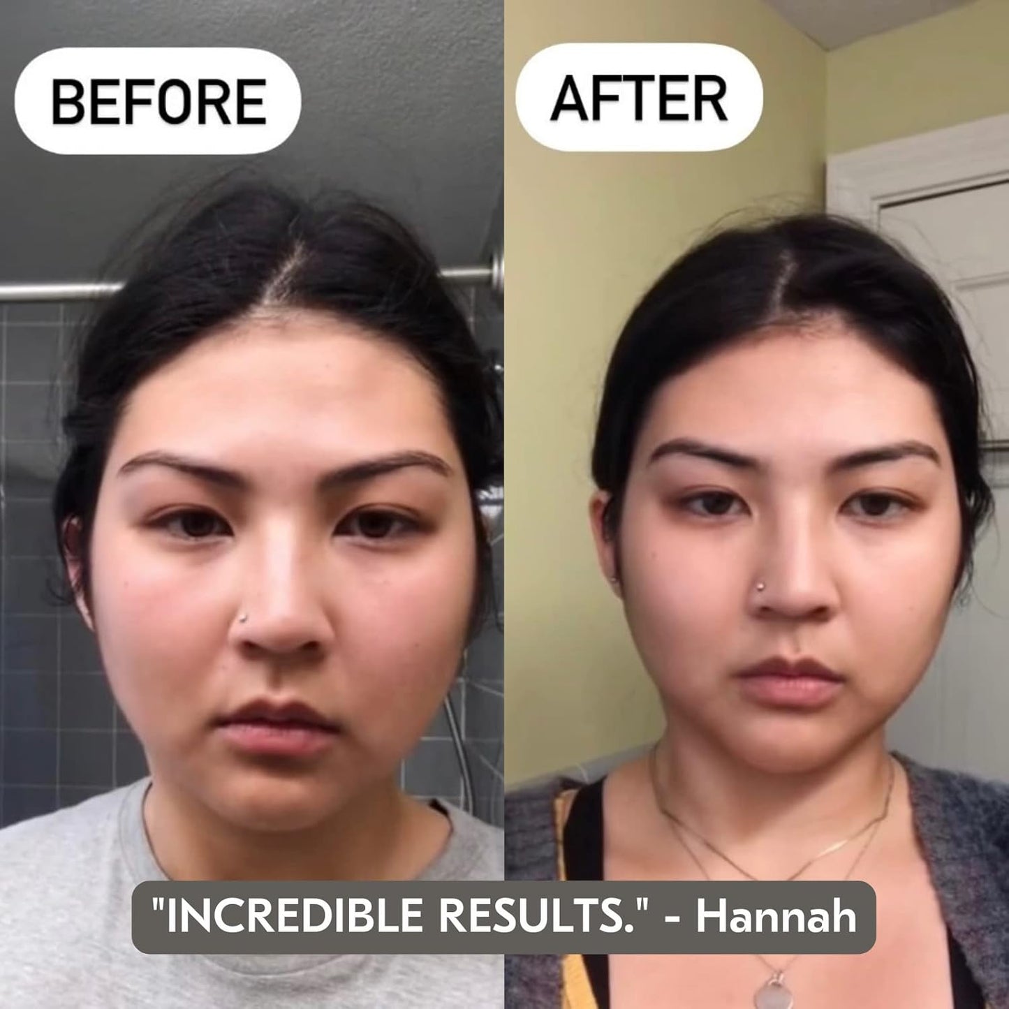 Mount Lai Jade Gua Sha Facial Tools, Jade Roller and Gua Sha Facial Tools Set, Guasha Tool for Face to Relieve Muscle Tension and Reduce Puffiness, Anti Aging Skin Care Sets for Women