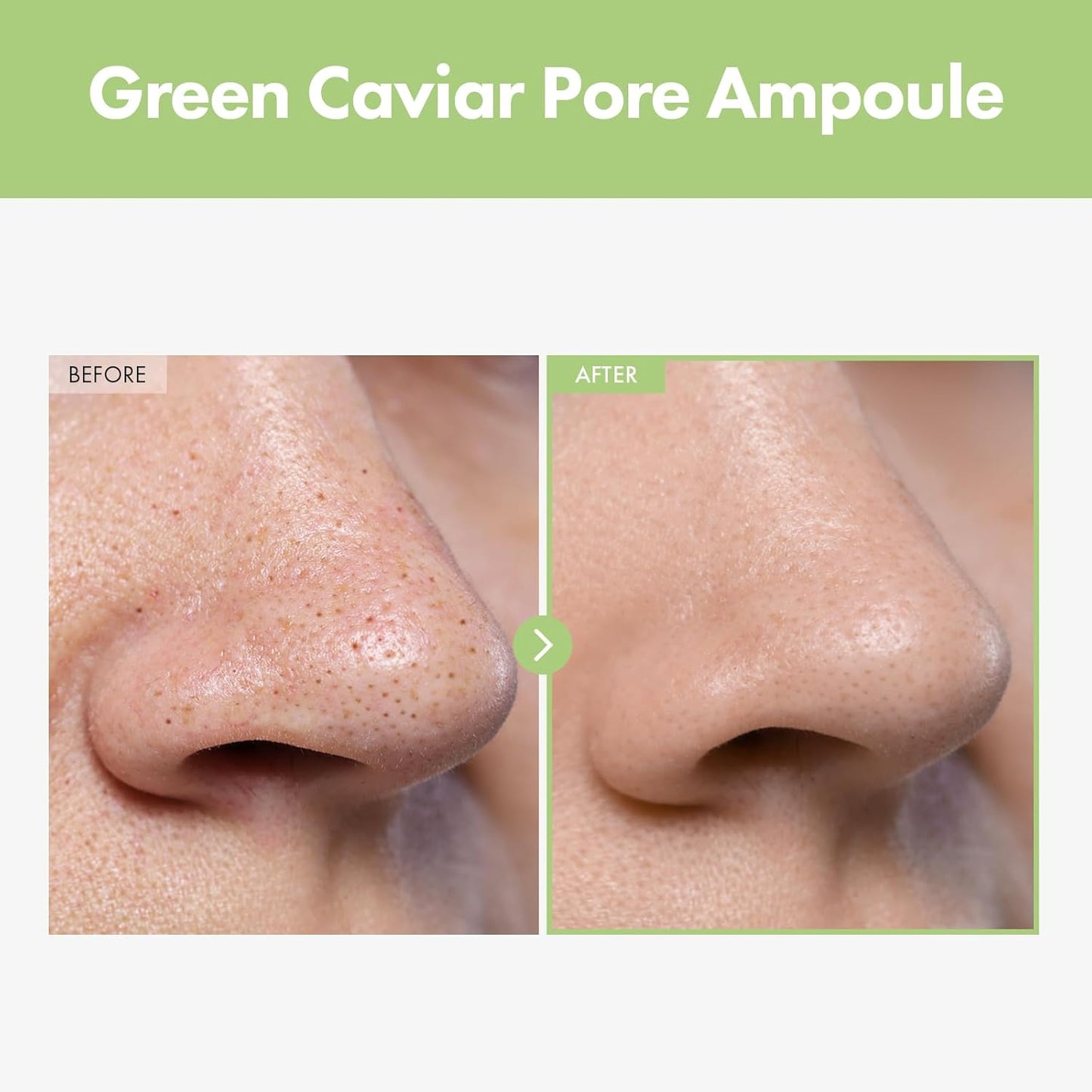 Green Caviar Pore Ampoule With 2,500ppm Green Caviar, Niacinamide, Pore Minimizer, Hydrating, Firming, Pore Tightening, Reduces Pores, Korean Skin Care, 33ml, 1.11 fl.oz.