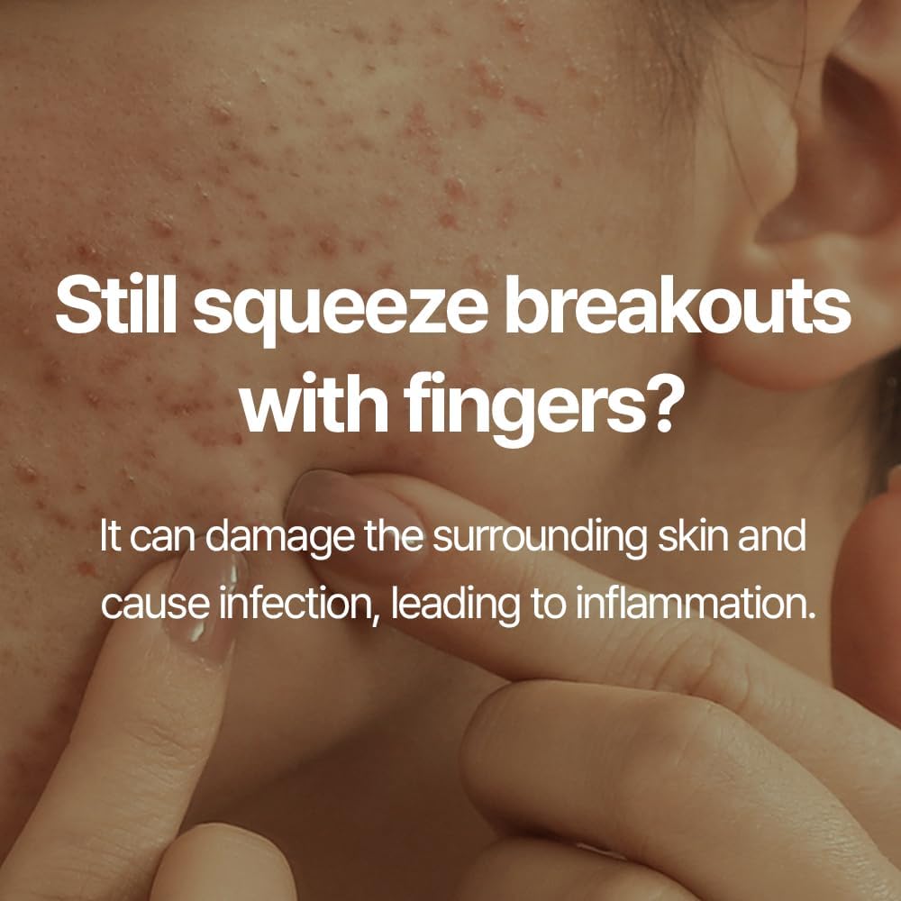 Pyunkang Yul PKY Zit Extractor Set, Tin Case Included, Extractor Tools for Zit Removal on Face, Stainless Steel Slip Free Use (3 Piece Kit)