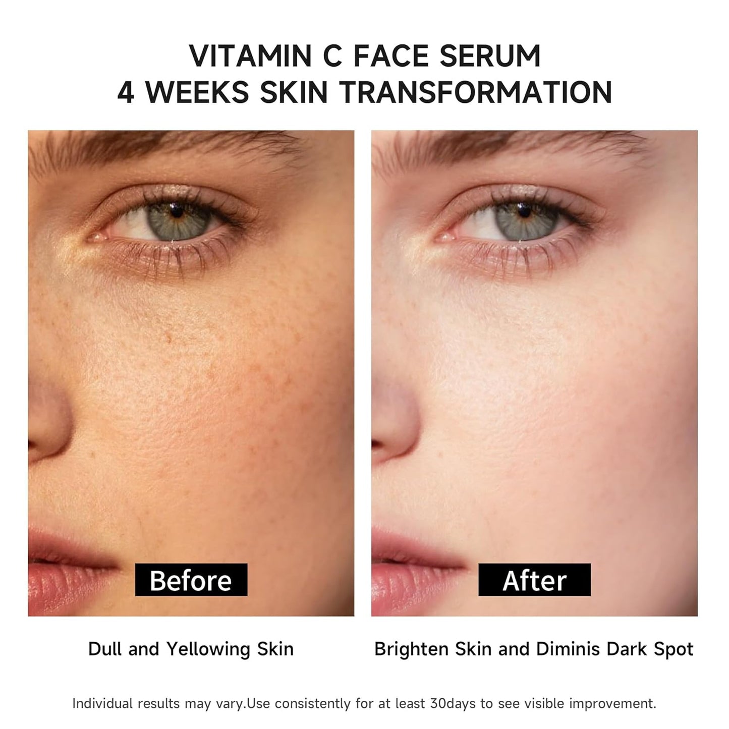 Vitamin C Face Serum with Glutathione, Hyaluronic Acid & Aloe Vera – Lightweight Brightening & Hydrating Ampoule for Daily Skincare, Dark Spots, Sensitive Skin Friendly - (1.0 ml)*30 Vials