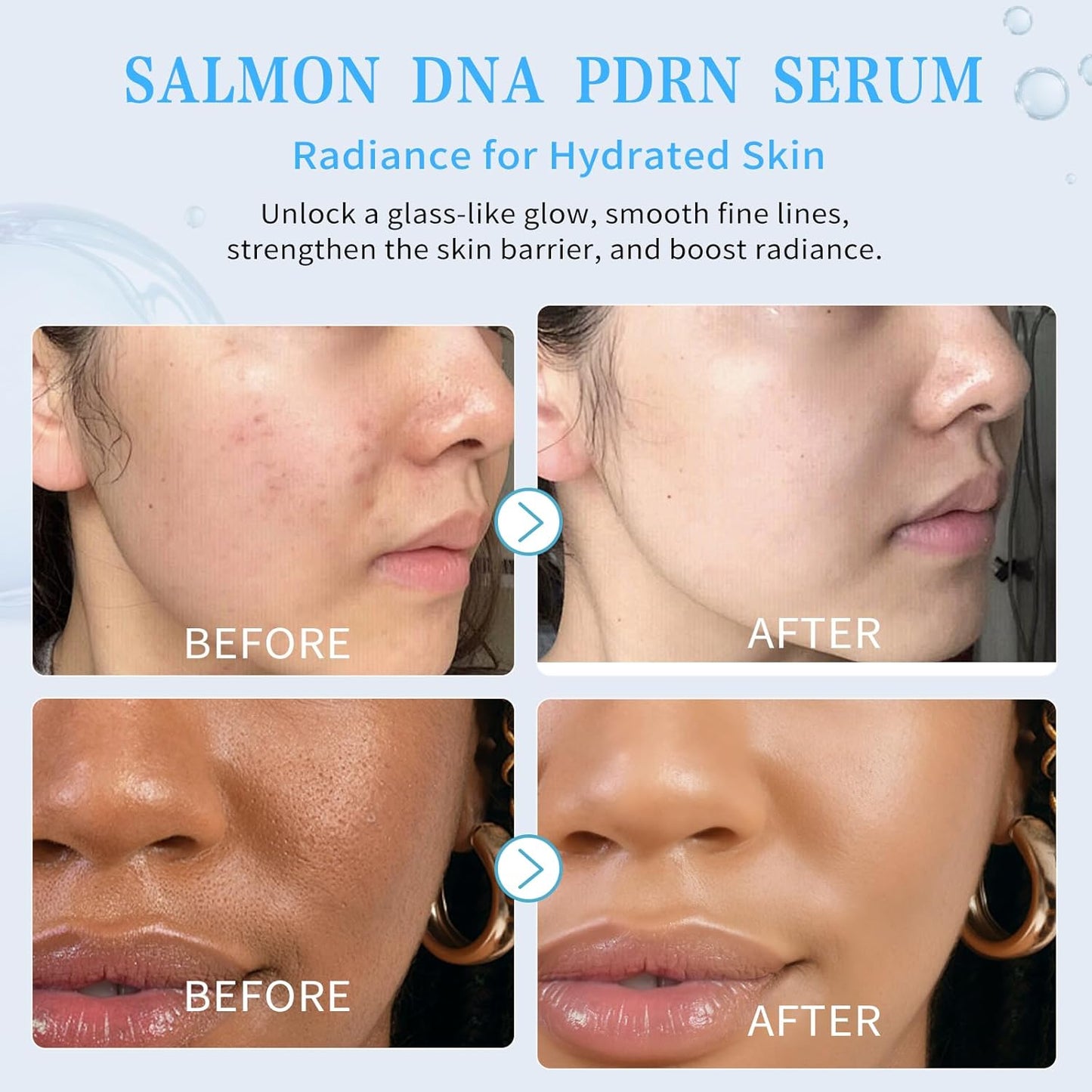 Salmon DNA PDRN Peptide Serum | 99% Salmon DNA PDRN Intensive Ampoule | Peptide, Collagen, Hyaluronic Acid, Niacinamide - Uneven Skin Tone, Anti-Aging, Moisturizing | Korean Skincare 0.05 fl oz x 30e