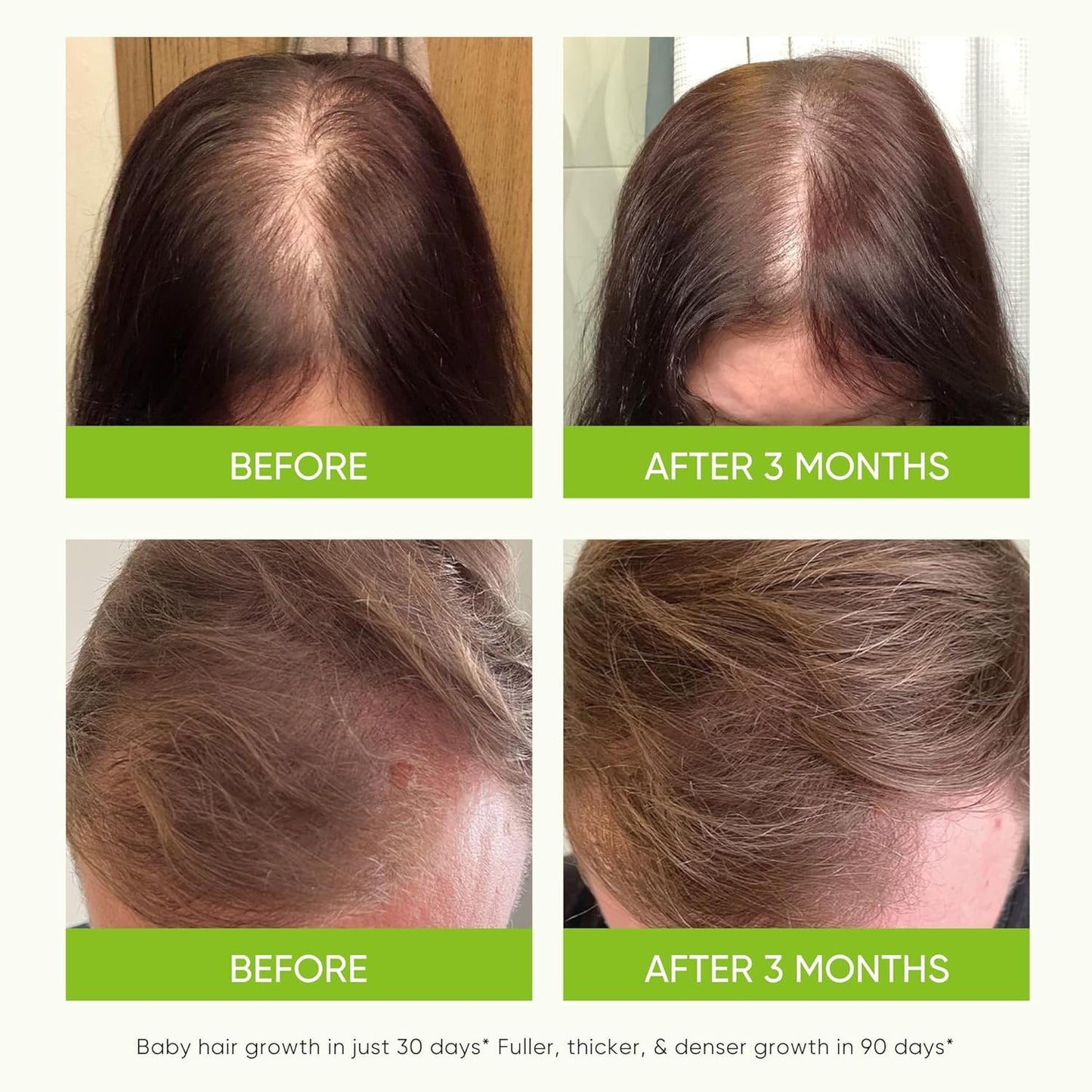 Hair Growth Serum Spray - with Rosemary Batana Oil Biotin for Hair Loss and Thinning - Thicker Fuller Longer - for Women and Men 2.7 Fl Oz (Pack of 1)