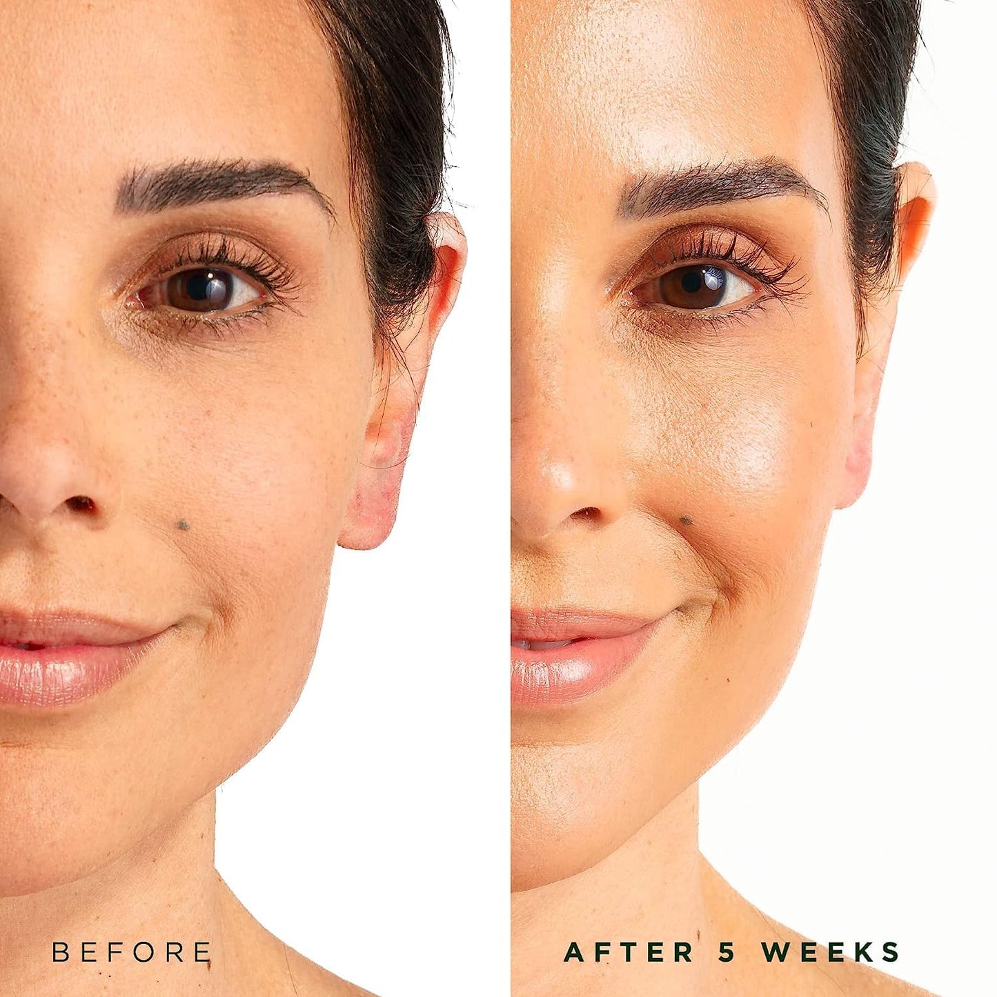 Tree of Life Beauty Hydrating Facial Serum - Super 20% Vitamin C+ with Vitamin E - Brightening & Smoothing for Dry/Sensitive Skin - Anti-Aging & Dark Spot Treatment - 1 Fl Oz