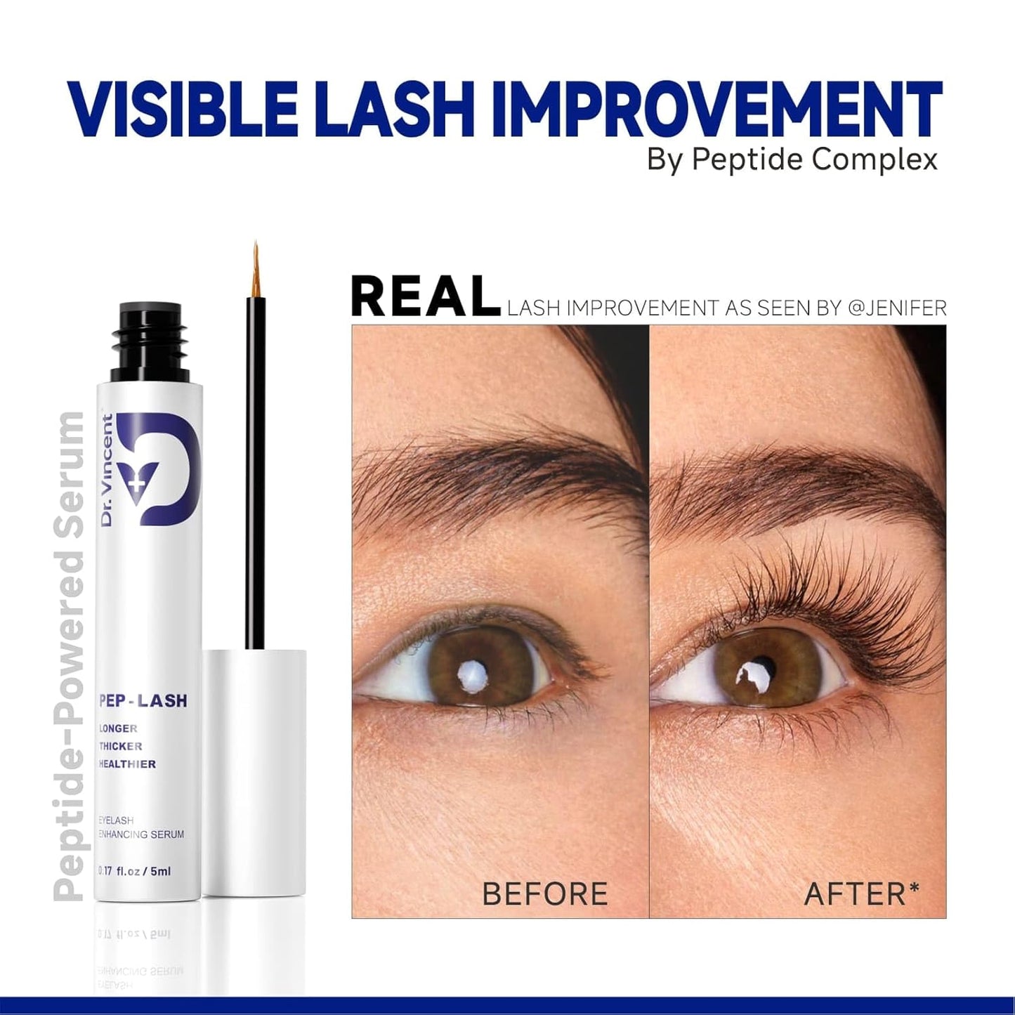 Lash Serum for Eyelash Growth – Eyelash Growth Serum Advanced Peptide Formula with 2.3× Absorption for Fuller, Thicker & Longer Lashes – Vegan & Cruelty-Free, Clinically Tested – 5ml