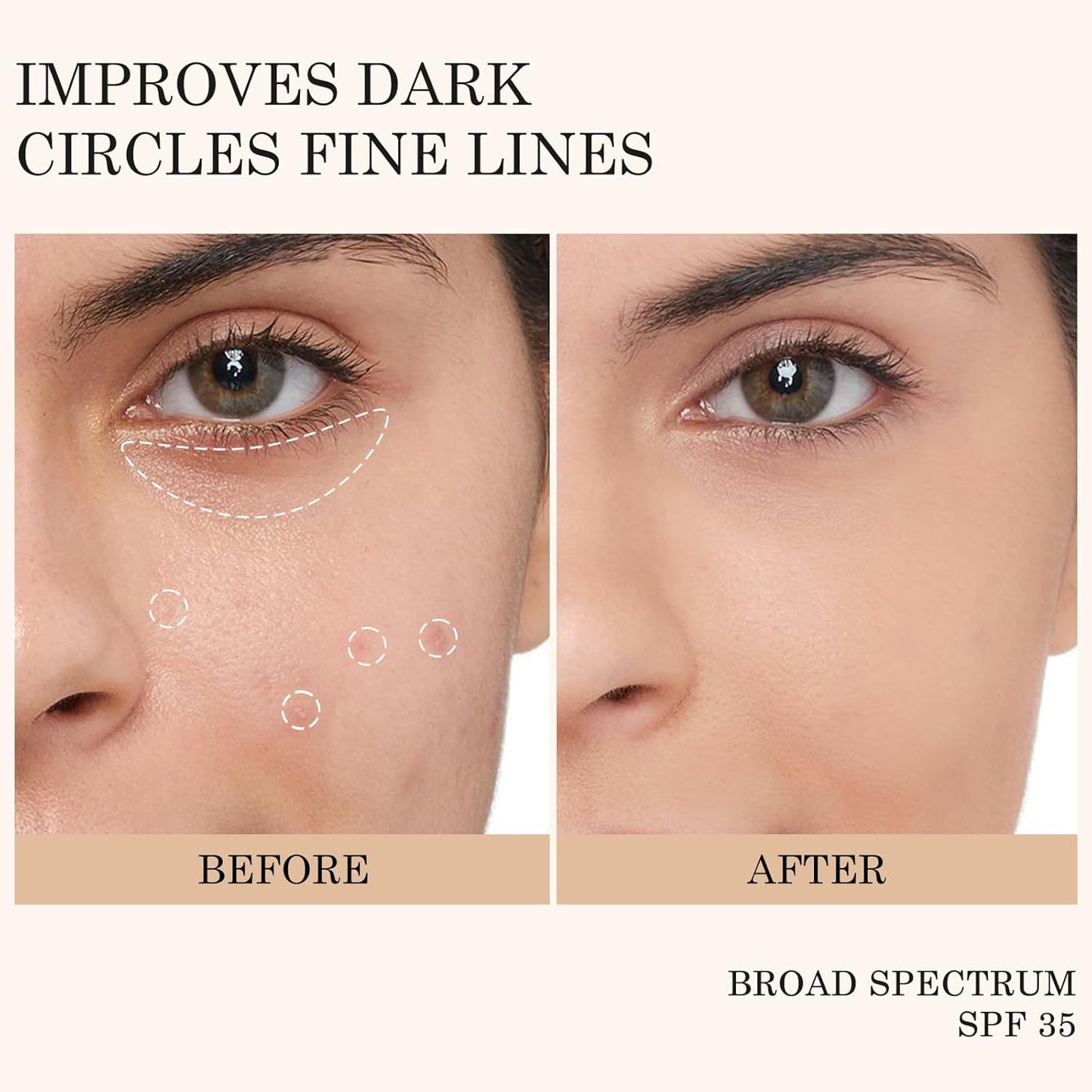 KYDA Mineral Sunscreen Eye Cream, 3-in-1 Anti-Aging Eye Cream, SPF 35, for Dark Circle and Fine Lines, Medium