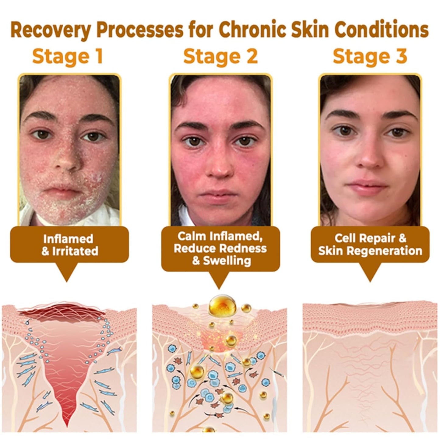 Bee Venom Skin Restoration Cream, Bee Venom Skin Treatment Cream, Repair skin and Firming, Effective In Reducing Blemishes (4)