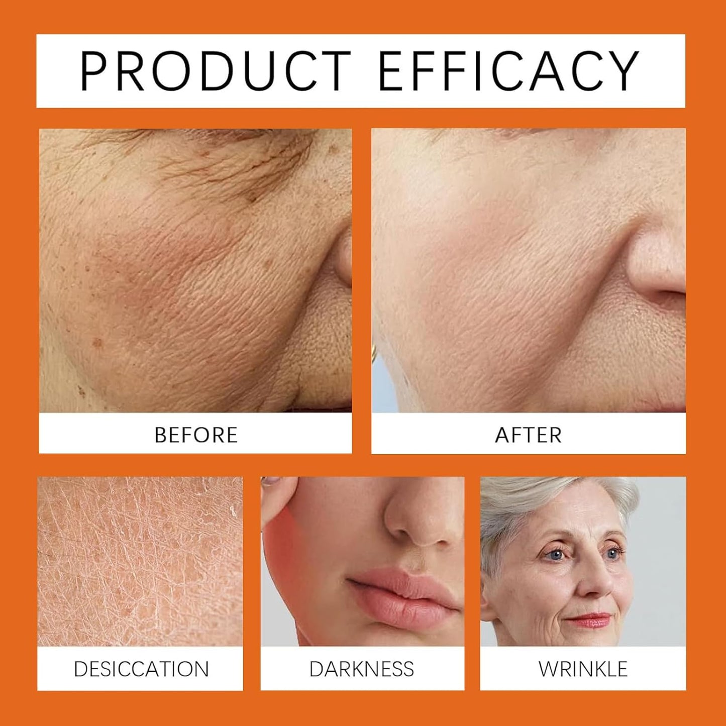 Bee Venom Comprehensive Cream, Professional bee venom cream for Removing and Repair, APKAPK Bee Venom Skin Treatment Cream, Natural Serum Suitable for All Skin Types (4 Pack)