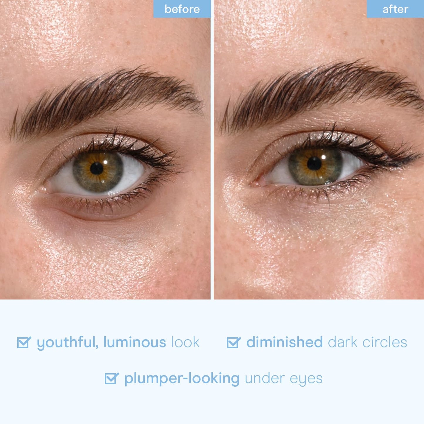 Baebody Advanced Snail Mucin Under Eye Masks (6 Pairs), Under Eye Patches for Puffy Eyes and Dark Circles, Hydrating Under Eye Patches to Reduce Fine Lines, Under Eye Patches Korean Inspired