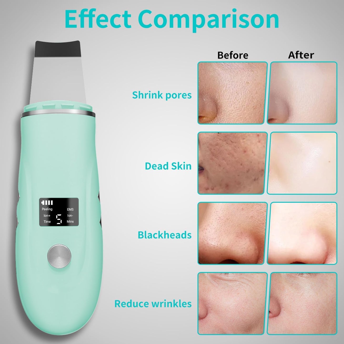 Skin Scrubber Facial Spatula - 4-in-1 Deep Cleansing Tool for Pore Extraction, Fast Charging Dock Blackhead Remover Face Spatula for Facial Skincare Women Gift (Green)