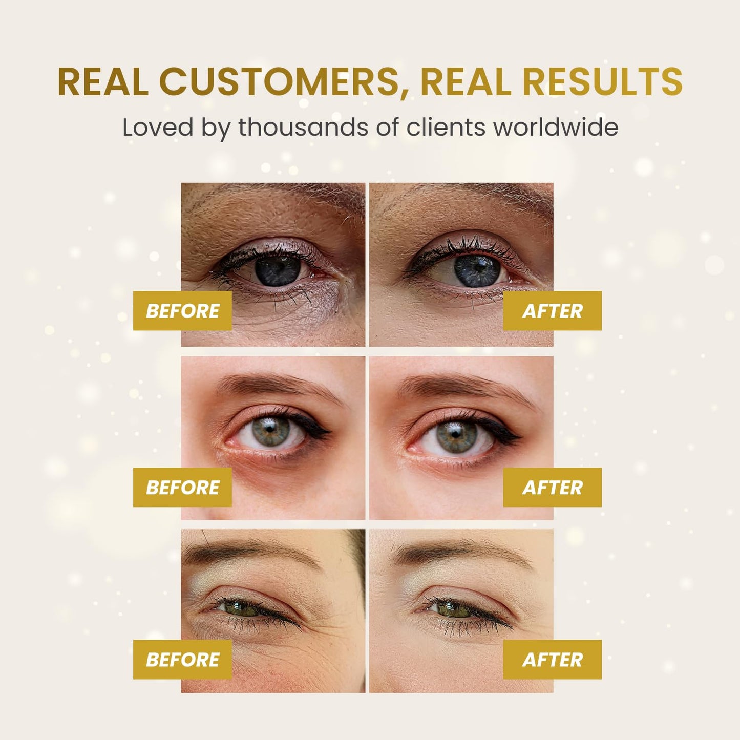 PLANTIFIQUE Gold Eye Patches for Puffy Eyes and Dark Circles 5 Pairs Under Eye Masks for Dark Circles and Puffiness Eye Gels with Collagen & Caffeine Eye Patches Gold Eye Mask Skincare