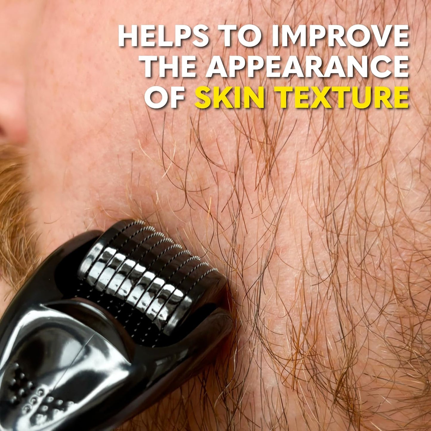 The Beard Club Derma Roller for Face, Body and Scalp - Microneedling for Men and Women with 540 Titanium Microneedles - Beard Roller & Micro Needling Scalp Hair - Silver & Black