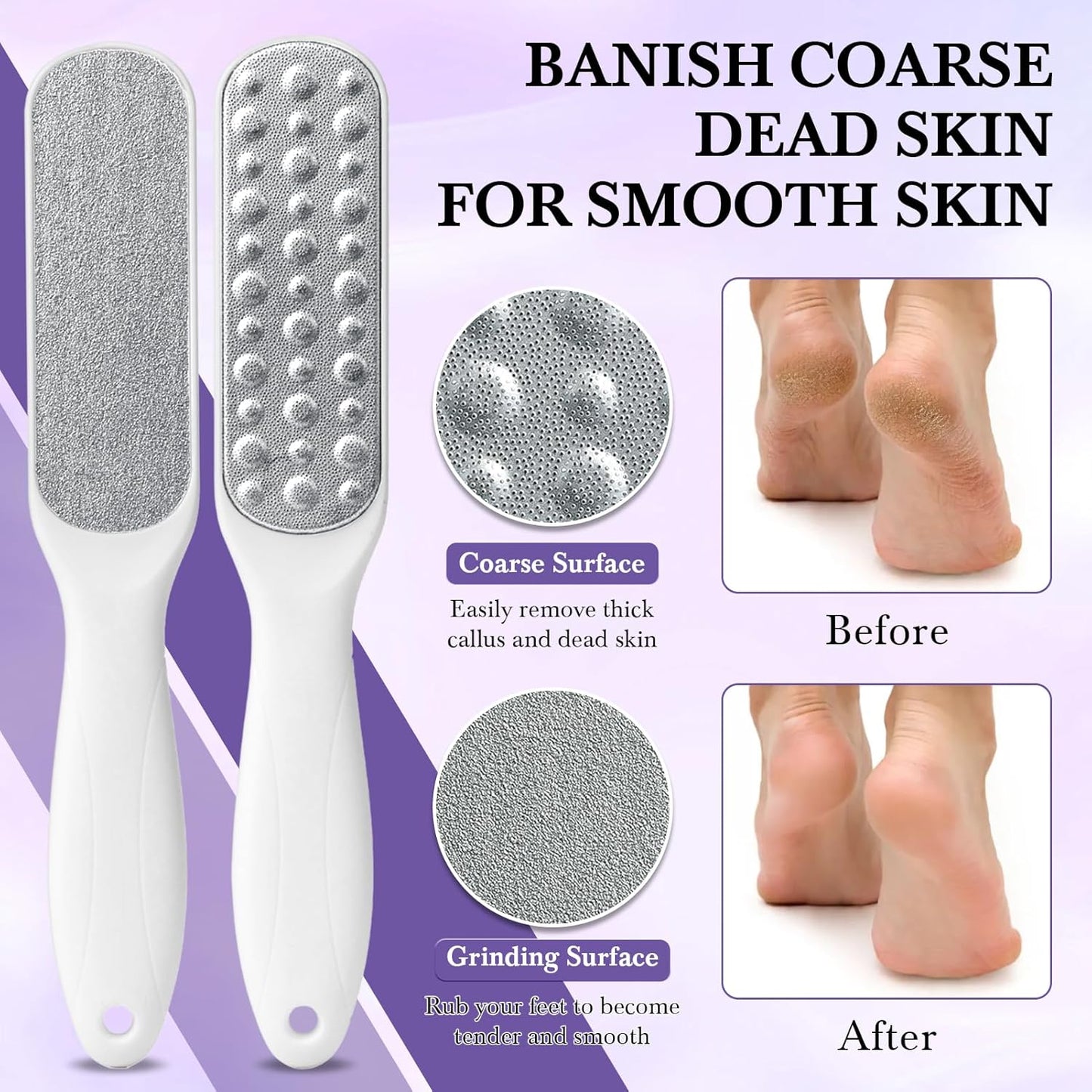 Foot Soak Set Callus Remover Pedicure Kit - Urea Cream 40%, Lavender Soak Salt with Epsom Salt & Foot File for Dead Skin, Foot Care Kit for Dry Cracked Heels at Home