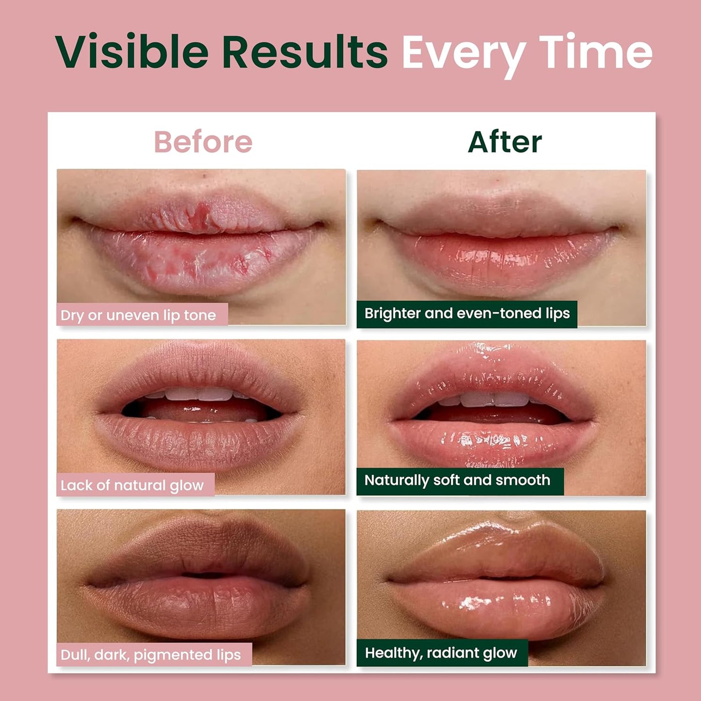 Vegan Lip Balm for Dull, Dark & Smokers' Lips | Naturally – Hydrating & Moisturizing - Antioxidant-Rich