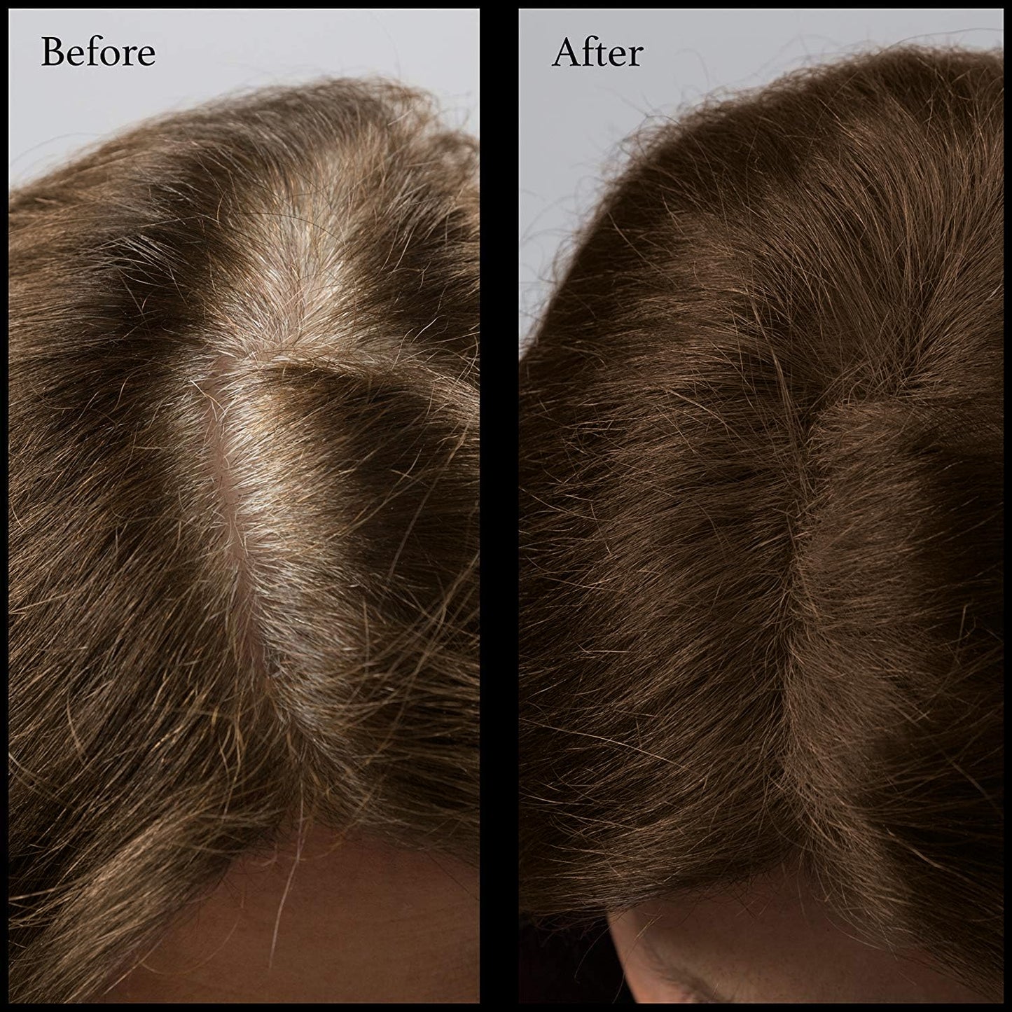 Hair Root Touch Up Powder - Dark Brown - 11 True-to-Nature Root Concealer Shades - Long-lasting, Fragrance Free, Talc & Paraben Free - Without Brush