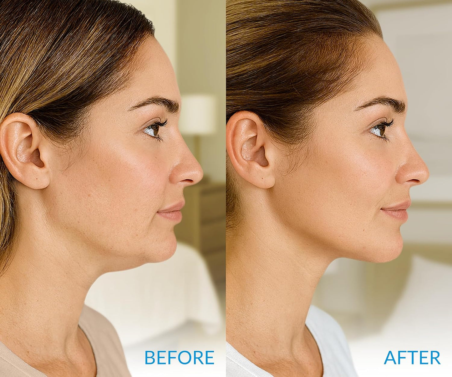 Stylia MaxiLift V-Line Lifting Collagen Face Mask – Enhanced Double Chin Reducer – Jawline Shaper Face Lifting Masks – Firming Neck Lift Collagen Mask – Chin Strap for Sleeping – Hyaluronic Aloe 5PC