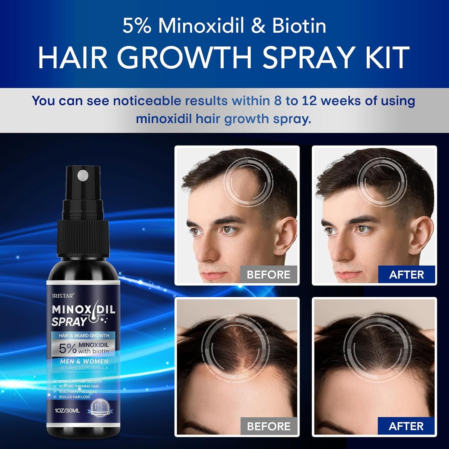5% Minoxidil for Men Hair, Minoxidil for Women Hair Growth, Minoxidil for Men Beard, Minoxidil Spray, Minoxidil 5 Percent, Minoxidil 5% Hair Regrowth for Men 30ml x 2 Bottles
