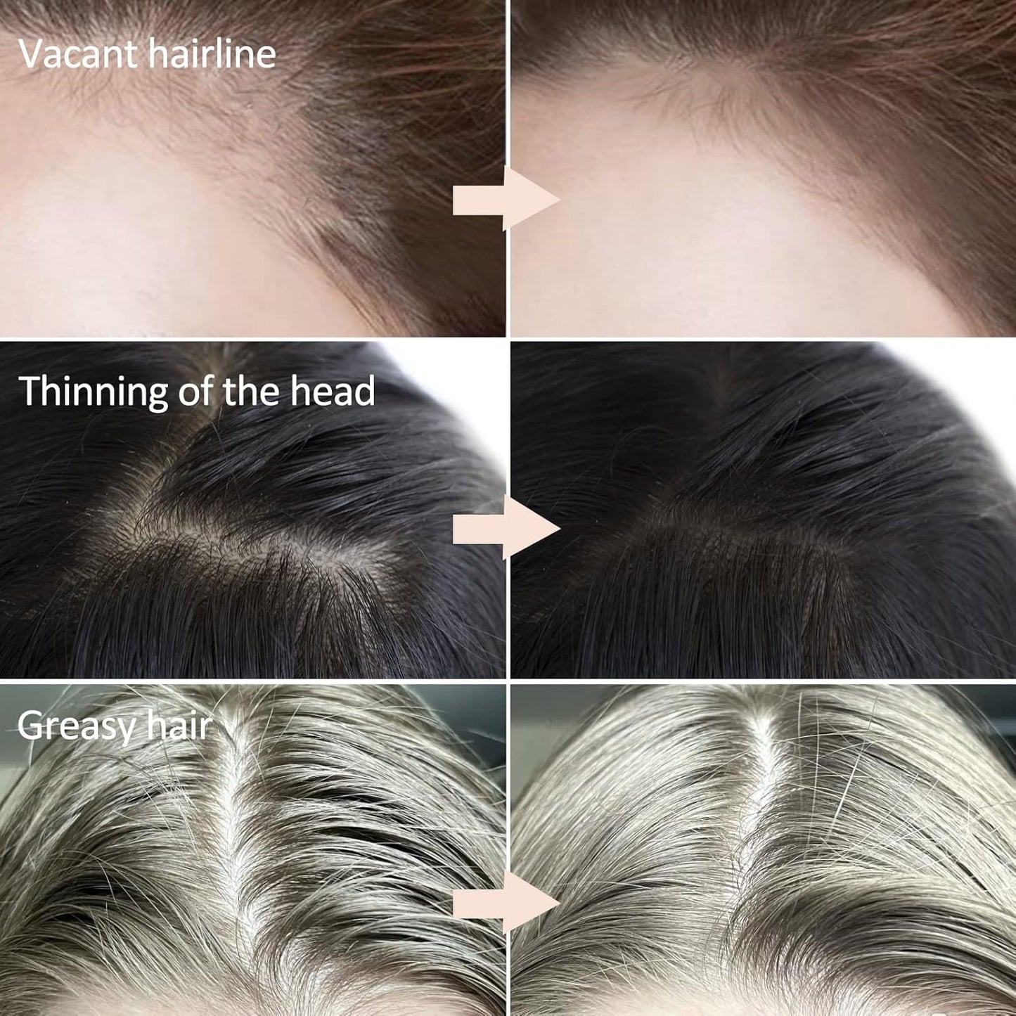 Boobeen Root Touch Up Powder Shadow Cover for Hair Loss, Hairline for Women and Men