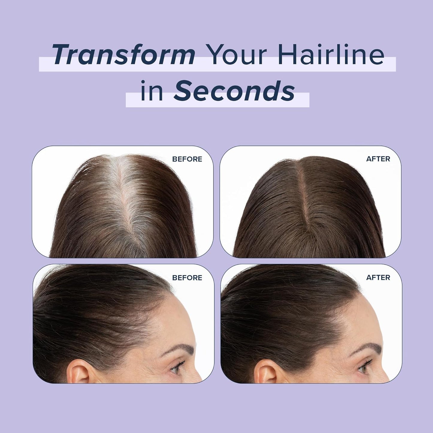 TRUHAIR Root & Scalp Cover Up Refill, Waterproof Pressed Powder for Gray Coverage, Bald Spots & Thinning Hair, Root Touch Up Color, 0.35 oz (Red)