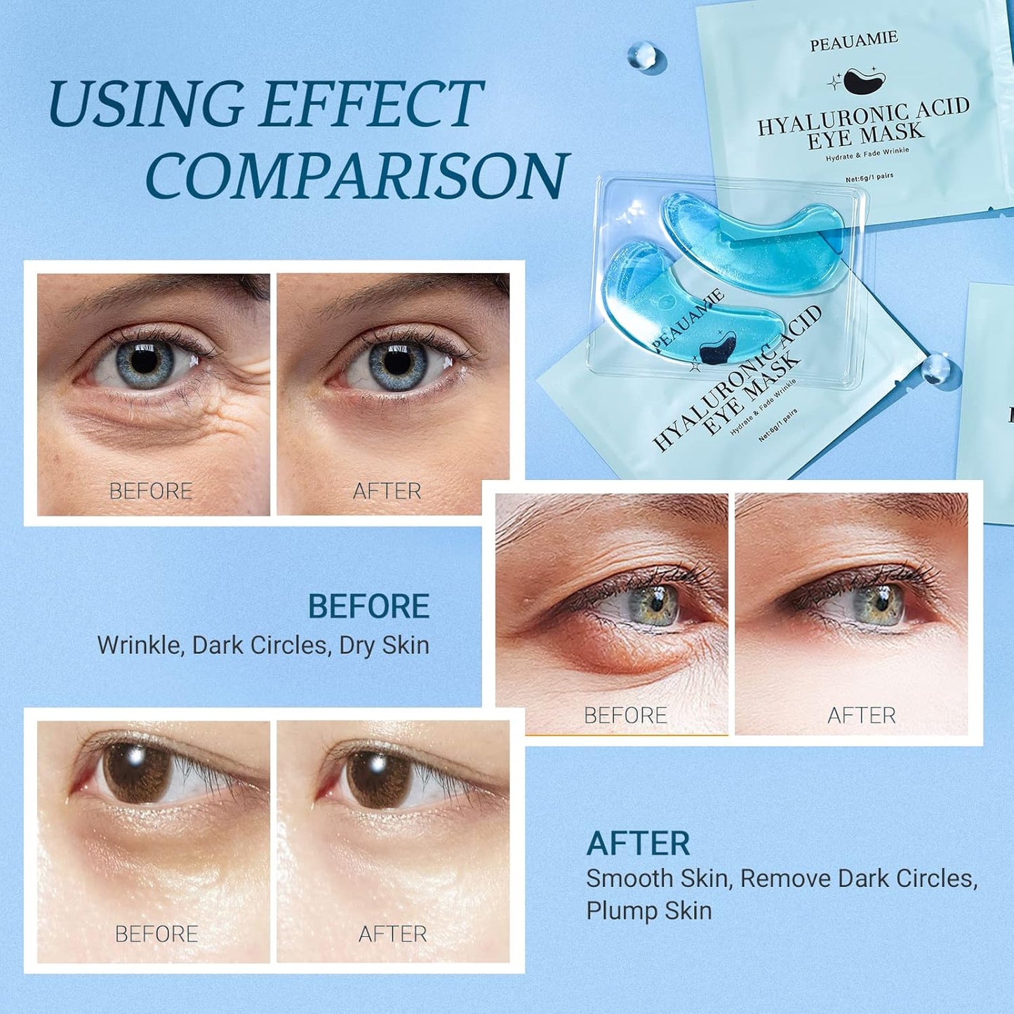 Under Eye Patchs (30 Pairs) Hyaluronic Acid Eye Mask for Dark Circles and Puffiness Wrinkle Eye Bags (Hyaluronic Acid)