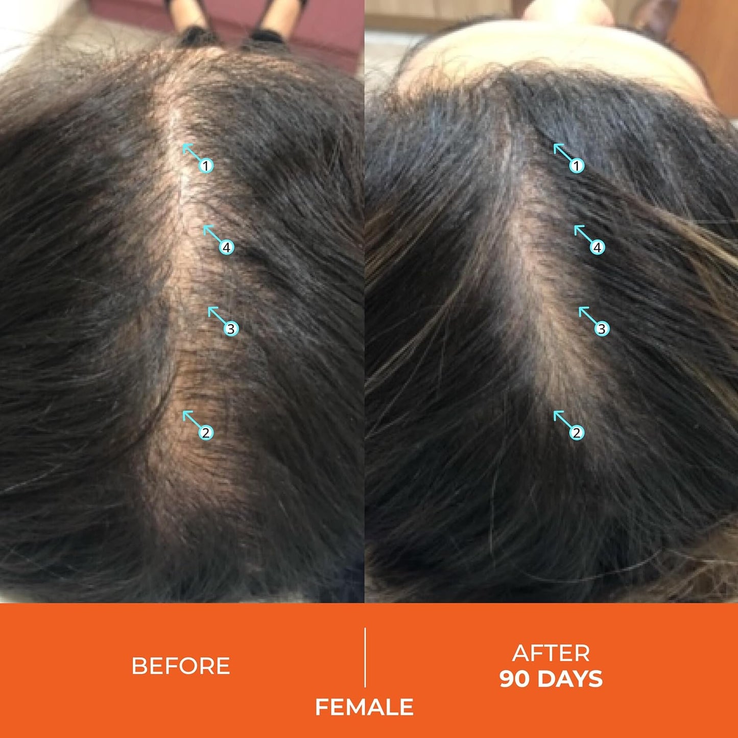 DS Labs Revita Hair Vitamin Gummies - Thickening & Strengthening Hair Supplement with Biotin, Zinc, Iron, Magnesium, Vitamin D & Melatonin, Fuller, Healthier-Looking Hair, Vegan & Gluten-Free